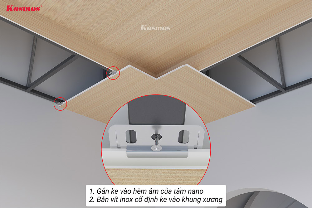 Gắn ke chuyên dụng vào hèm âm, cố định vào thanh xương bằng vít inox
