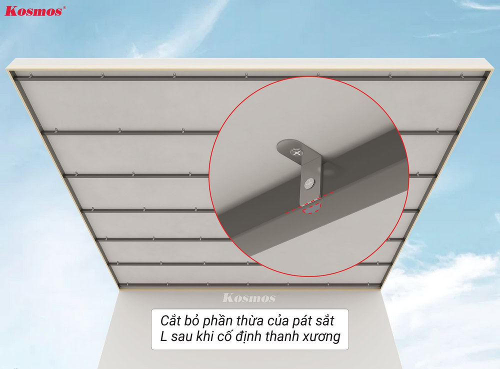 Cắt bỏ phần thừa của pát sắt sau khi cố định thanh xương
